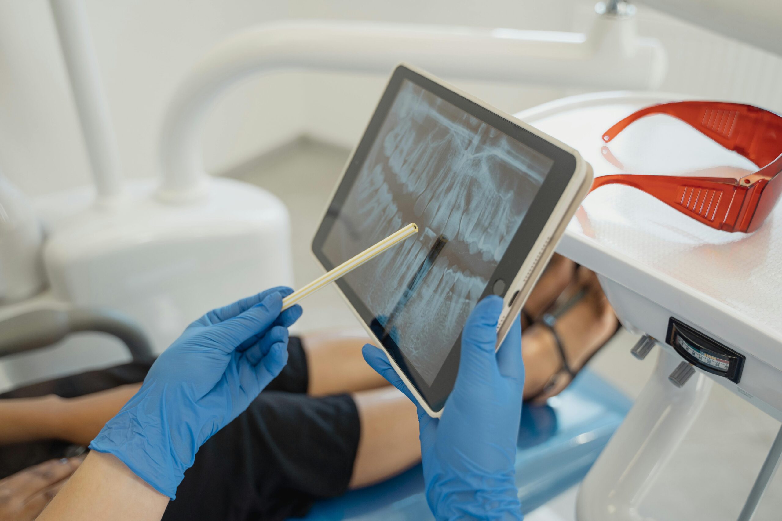 Root Canal Treatment at Lebanon Park Dental Group