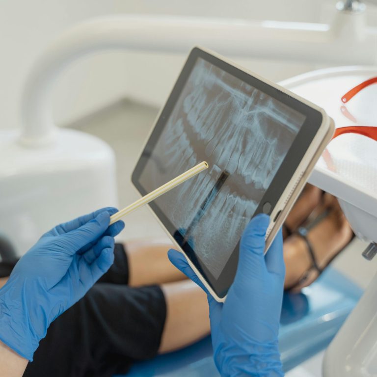 Root Canal Treatment at Lebanon Park Dental Group